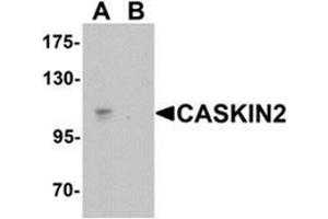 Image no. 2 for anti-CASK Interacting Protein 2 (CASKIN2) (N-Term) antibody (ABIN1450113)