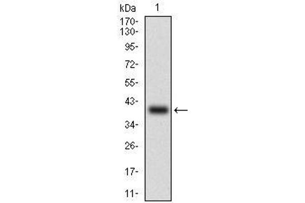 anti-ATP-Binding Cassette, Sub-Family B (MDR/TAP), Member 1 (ABCB1) (AA 632-693) antibody