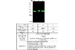 Image no. 4 for anti-Estrogen Receptor Binding Site Associated, Antigen, 9 (EBAG9) (AA 28-213) antibody (ABIN6923226)