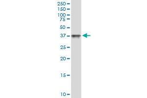Image no. 2 for anti-Melanoma Antigen Family A, 11 (MAGEA11) (AA 1-319) antibody (ABIN517705)