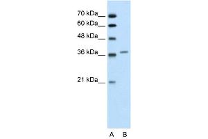 Image no. 2 for anti-Aminolevulinate Dehydratase (ALAD) (Middle Region) antibody (ABIN2776922)