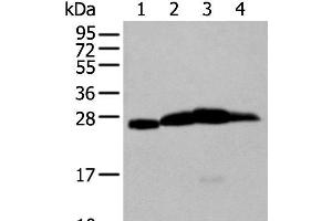 Western blot analysis of Mouse brain tissue Rat brain tissue Human cerebrum tissue Human cerebella tissue lysates using MOG Polyclonal Antibody at dilution of 1:250