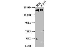 UNC13B Antikörper  (AA 12-215)