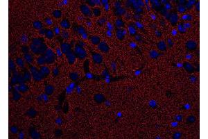 Image no. 3 for anti-Solute Carrier Family 1 (Glial High Affinity Glutamate Transporter), Member 2 (SLC1A2) (AA 146-161), (Extracellular Domain) antibody (ABIN1742506)
