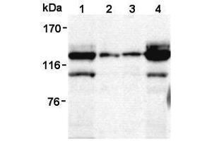 Image no. 2 for anti-Signal-Induced Proliferation-Associated 1 (SIPA1) antibody (ABIN1449260)