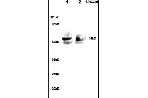 Image no. 3 for anti-alpha-1-B Glycoprotein (A1BG) (AA 301-400) antibody (ABIN872952)