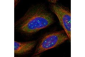 Image no. 3 for anti-Signal Recognition Particle 72kDa (SRP72) antibody (ABIN5588767)