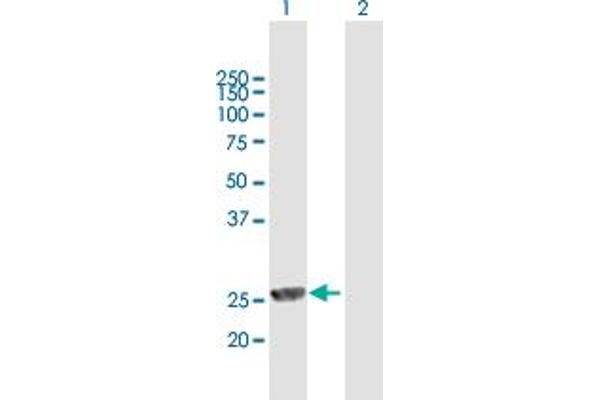 MPHOSPH8 antibody  (AA 1-259)