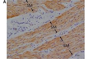Immunohistochemical studies with an anti-FFA1 antibody on porcine lower esophageal sphincter.