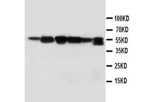 Image no. 2 for anti-Abl-Interactor 1 (ABI1) (AA 483-494), (C-Term) antibody (ABIN3043678)