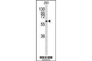 Western Blotting (WB) image for anti-Parafibromin (CDC73) antibody (ABIN2158162)