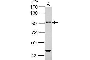 Image no. 1 for anti-Transforming Growth Factor, beta Receptor III (TGFBR3) (N-Term) antibody (ABIN2856649)