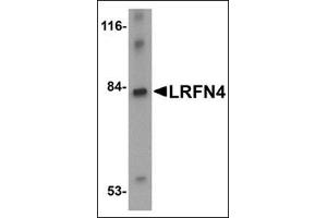 Image no. 2 for anti-Leucine Rich Repeat and Fibronectin Type III Domain Containing 4 (LRFN4) (C-Term) antibody (ABIN500192)
