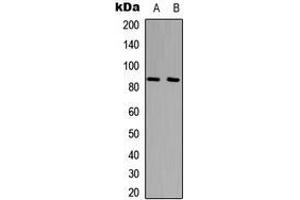 Image no. 1 for anti-UTP14, U3 Small Nucleolar Ribonucleoprotein, Homolog A (UTP14A) (Center) antibody (ABIN2972455)