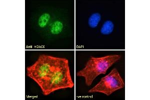 Image no. 5 for anti-Histone Deacetylase 6 (HDAC6) (C-Term) antibody (ABIN5539540)