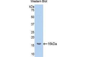 Image no. 4 for Nucleophosmin (Nucleolar phosphoprotein B23, Numatrin) (NPM1) ELISA Kit (ABIN6574308)