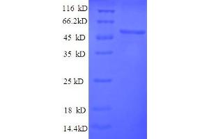 Image no. 1 for Thymidine Kinase 1, Soluble (TK1) (AA 1-376), (full length) protein (His tag) (ABIN5710502)