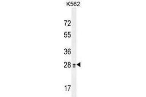 Image no. 3 for anti-Testis Expressed 13B (TEX13B) (AA 279-309), (C-Term) antibody (ABIN955166)