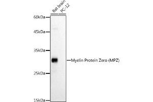 Western blot analysis of extracts of various cell lines, using Myelin Protein Zero (MPZ) antibody (ABIN3022393, ABIN3022394, ABIN1513218 and ABIN6218782) at 1:1000 dilution.