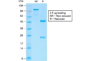 Image no. 7 for anti-Catenin (Cadherin-Associated Protein), beta 1, 88kDa (CTNNB1) antibody (ABIN6939211)