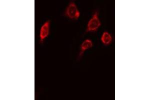 Image no. 4 for anti-V-Raf Murine Sarcoma 3611 Viral Oncogene Homolog (ARAF) (pSer299) antibody (ABIN6271430)