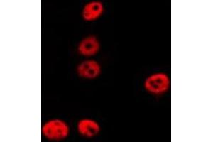 Image no. 1 for anti-REC8 Homolog (Yeast) (REC8) (Internal Region) antibody (ABIN6257459)