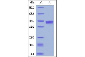 Image no. 2 for Interleukin-17 A/F Heterodimer (IL-17A/F) (AA 24-155) protein (His tag,AVI tag,Biotin) (ABIN6253197)