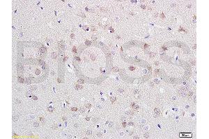 Image no. 2 for anti-Cadherin 2 (CDH2) (AA 701-800) antibody (ABIN738726)