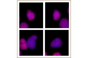 Image no. 2 for anti-E1A Binding Protein P300 (EP300) antibody (ABIN6972466)