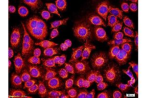 Image no. 2 for anti-Colony Stimulating Factor 2 Receptor, Alpha, Low-Affinity (Granulocyte-Macrophage) (CSF2RA) (AA 101-230) antibody (ABIN686812)