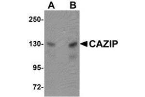 Image no. 2 for anti-Microtubule-associated Tumor Suppressor Candidate 2 (MTUS2) (C-Term) antibody (ABIN499583)