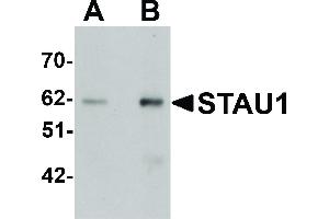 STAU1/Staufen Antikörper  (C-Term)