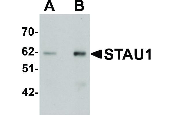 anti-Staufen Double-Stranded RNA Binding Protein 1 (STAU1) (C-Term) antibody