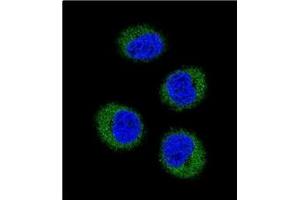 Image no. 1 for anti-Gardner-Rasheed Feline Sarcoma Viral (V-Fgr) Oncogene Homolog (FGR) (AA 11-40), (N-Term) antibody (ABIN359981)