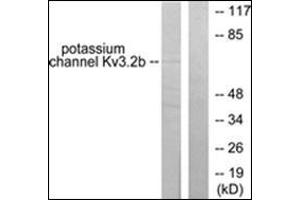 Image no. 2 for anti-Potassium Voltage-Gated Channel, Shaw-Related Subfamily, Member 2 (KCNC2) (C-Term) antibody (ABIN784577)