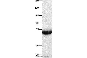 Image no. 1 for anti-BPI Fold Containing Family B, Member 3 (BPIFB3) antibody (ABIN2426147)