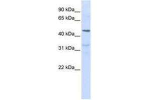 Image no. 1 for anti-Interleukin 28 Receptor, alpha (Interferon, lambda Receptor) (IL28RA) (AA 72-121) antibody (ABIN6741017)