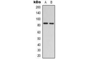 Image no. 1 for anti-RAD54-Like (RAD54L) antibody (ABIN2957740)