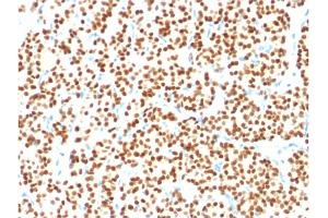 Image no. 4 for anti-Paired Box 8 (PAX8) (AA 60-261) antibody (ABIN6940923)
