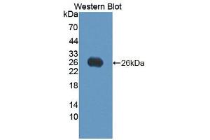 Image no. 2 for anti-Vascular Endothelial Growth Factor B (VEGFB) (AA 21-207) antibody (ABIN1078650)