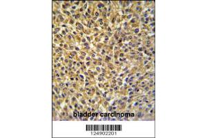 Immunohistochemistry (IHC) image for anti-Cysteine-Rich Protein 1 (Intestinal) (CRIP1) antibody (ABIN2158370)