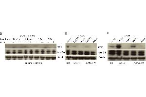 Image no. 85 for anti-Glyceraldehyde-3-Phosphate Dehydrogenase (GAPDH) (Center) antibody (ABIN2857072)