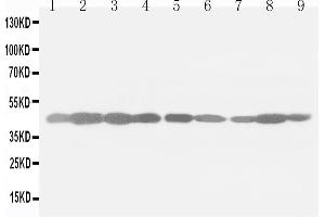 Image no. 2 for anti-Actin, beta (ACTB) (Cytosolic), (N-Term) antibody (ABIN3044484)