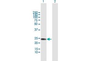 Image no. 2 for anti-Interferon, alpha 8 (IFNA8) (AA 1-189) antibody (ABIN516892)