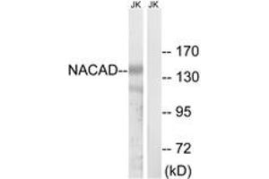 Image no. 1 for anti-NAC alpha Domain Containing (NACAD) (AA 376-425) antibody (ABIN1535054)