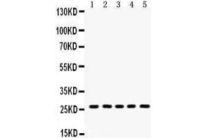 anti-Hydroxysteroid (17-Beta) Dehydrogenase 10 (HSD17B10) (AA 48-261) antibody