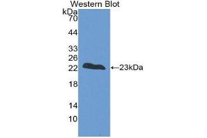 Image no. 1 for anti-Fast Skeletal Troponin I (TNNI2) (AA 1-182) antibody (ABIN1860816)