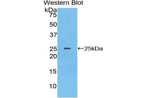 Image no. 1 for anti-Cathepsin K (CTSK) (AA 116-329) antibody (ABIN1077922)