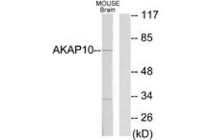 Image no. 1 for anti-A Kinase (PRKA) Anchor Protein 10 (AKAP10) (AA 10-59) antibody (ABIN1533509)