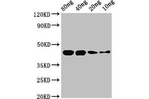 Streptococcal Pyrogenic Exotoxin B (SPEB) (AA 146-398) 抗体